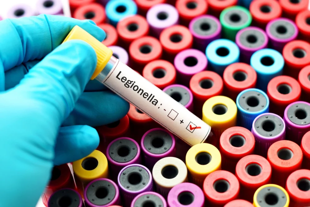 A test vial containing a water sample that has tested positive for Legionella.